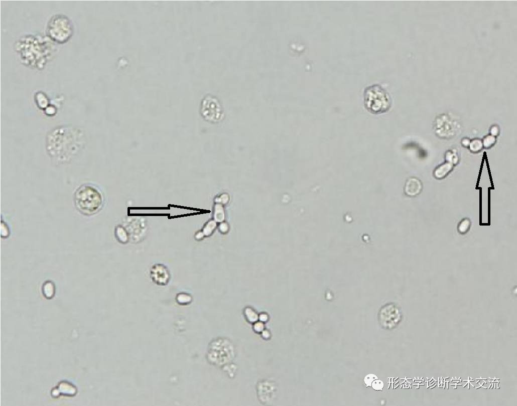 图3-1-1 尿液中常见红细胞-尿液沉渣实录-医学